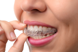 invisalign-dentist-providor-lebanon-nh-upper-valley